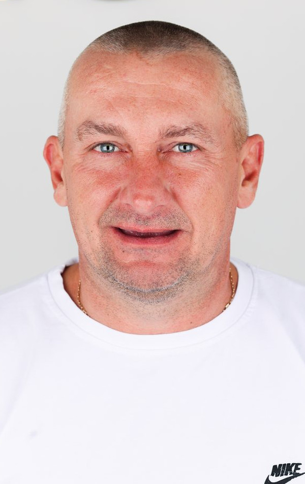 До стоматологічного лікування, Vitalii