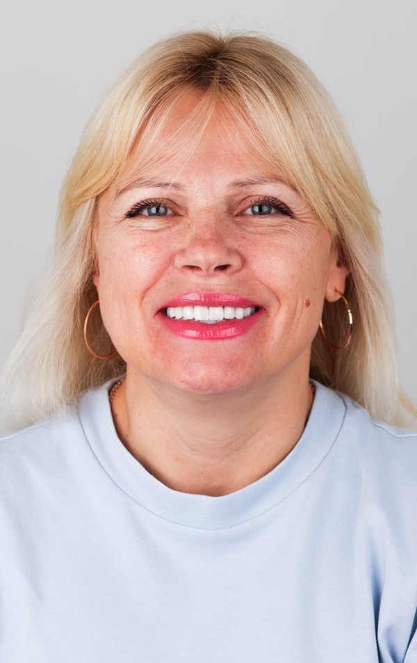 Після стоматологічного лікування, Oksana T.