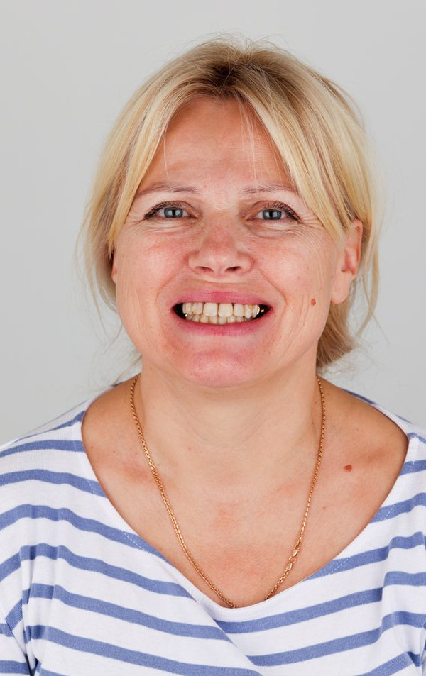 До стоматологічного лікування, Oksana T.
