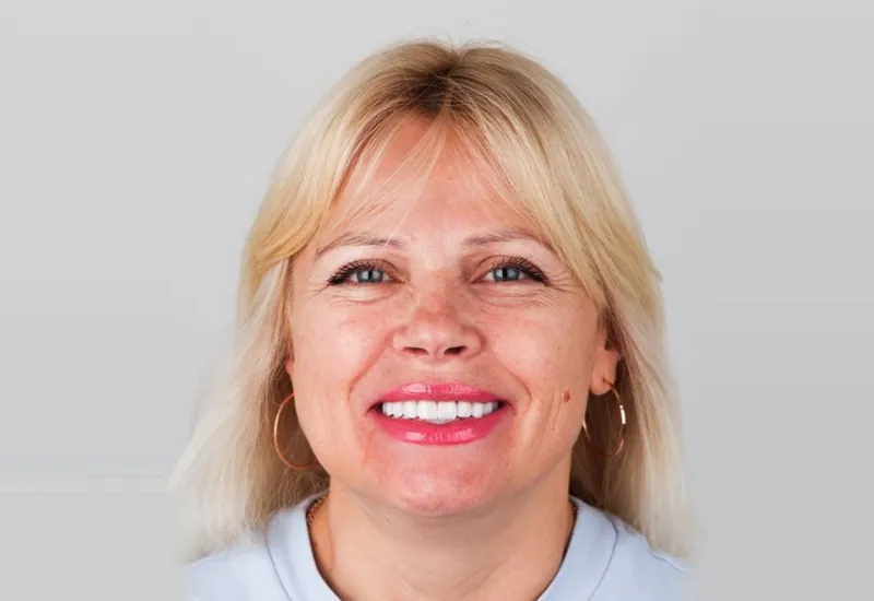 Oksana T. — результат стоматологічного лікування